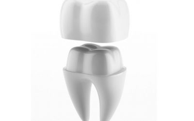 Fractured or Cracked Tooth: Think of a Crown