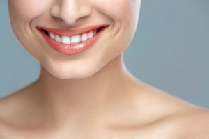 Woman smile. Teeth whitening Toronto