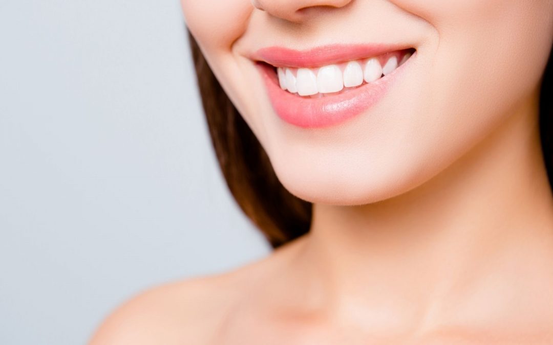 Teeth Whitening Can Boost Your Confidence