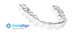 Average Cost of Invisalign Invisalign Toronto